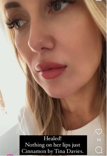 Lip-blush-after-fully-healing
