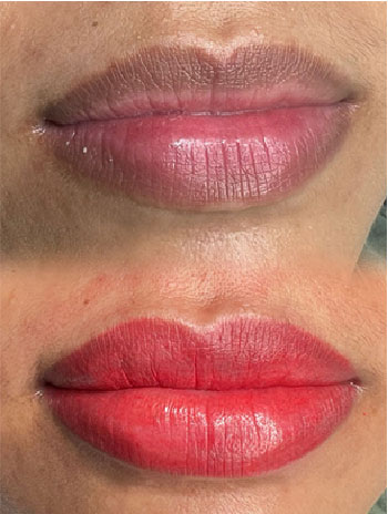 lip-blush-Leeds-before and after