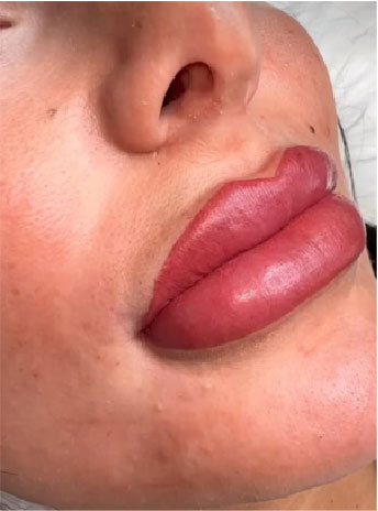 lip-blush-tattoo-in-Leeds