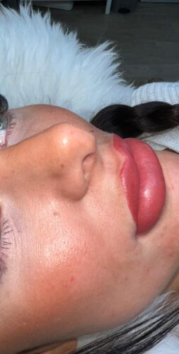 Lip Blush treatment - Perfect lips